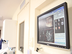 4．設備と技術を駆使し、患者さまの負担が少ない歯科治療を行います。